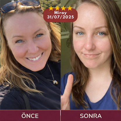 Nelviora™ Kalsiyum ve Kolajen Eksteri İçeren Multi Balm